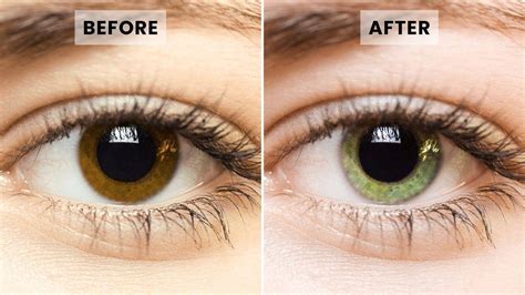 eye drops that change your eye color|permanent eye color change surgery.